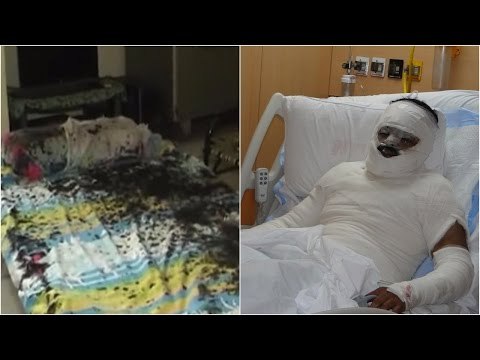 Jilted woman throws acid on veterinary doctor in Ghaziabad