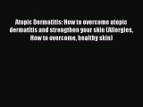 Download Atopic Dermatitis: How to overcome atopic dermatitis and strengthen your skin (Allergies