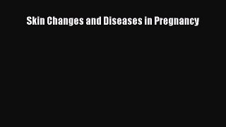 Download Skin Changes and Diseases in Pregnancy PDF Online