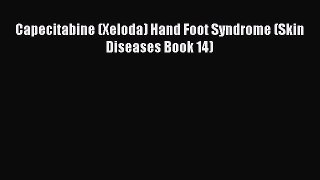 Download Capecitabine (Xeloda) Hand Foot Syndrome (Skin Diseases Book 14) PDF Free