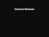 Download Cutaneous Melanoma PDF Free