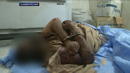 جثث بمستشفى عامرية الفلوجة لنازحين قضوا تحت التعذيب