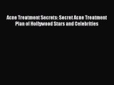 Download Acne Treatment Secrets: Secret Acne Treatment Plan of Hollywood Stars and Celebrities