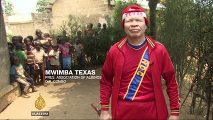 Meet Mwimba Makiese Alphonse Texas, the 'Mandela' for albinos
