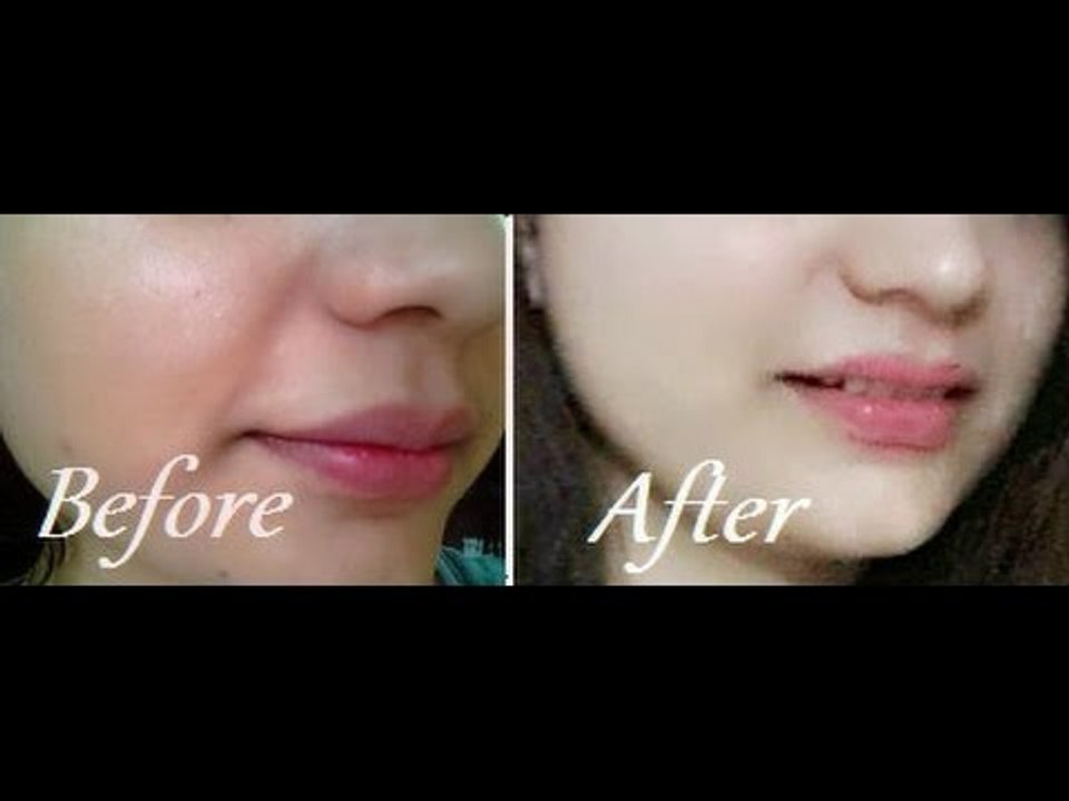 How to Remove Sun Tan From Your Face & Neck Instantly