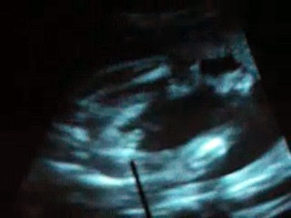 Melissa - Week 24, definitely a boy.