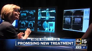 Cryoblation Breast Cancer Treatment at Arizona Breastnet