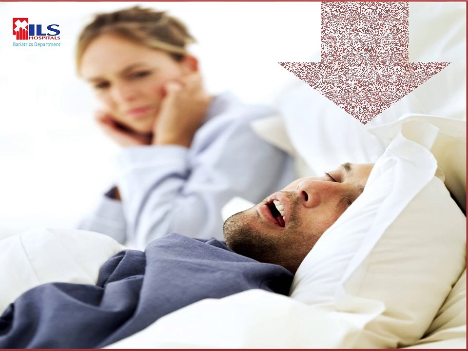 Stop being called as "Fat" - Get Laparoscopic Obesity Surgery to overcome obesity