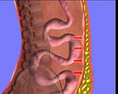 Slim Waist - Burn Fat without exercise or diet! - Weight Loss Program