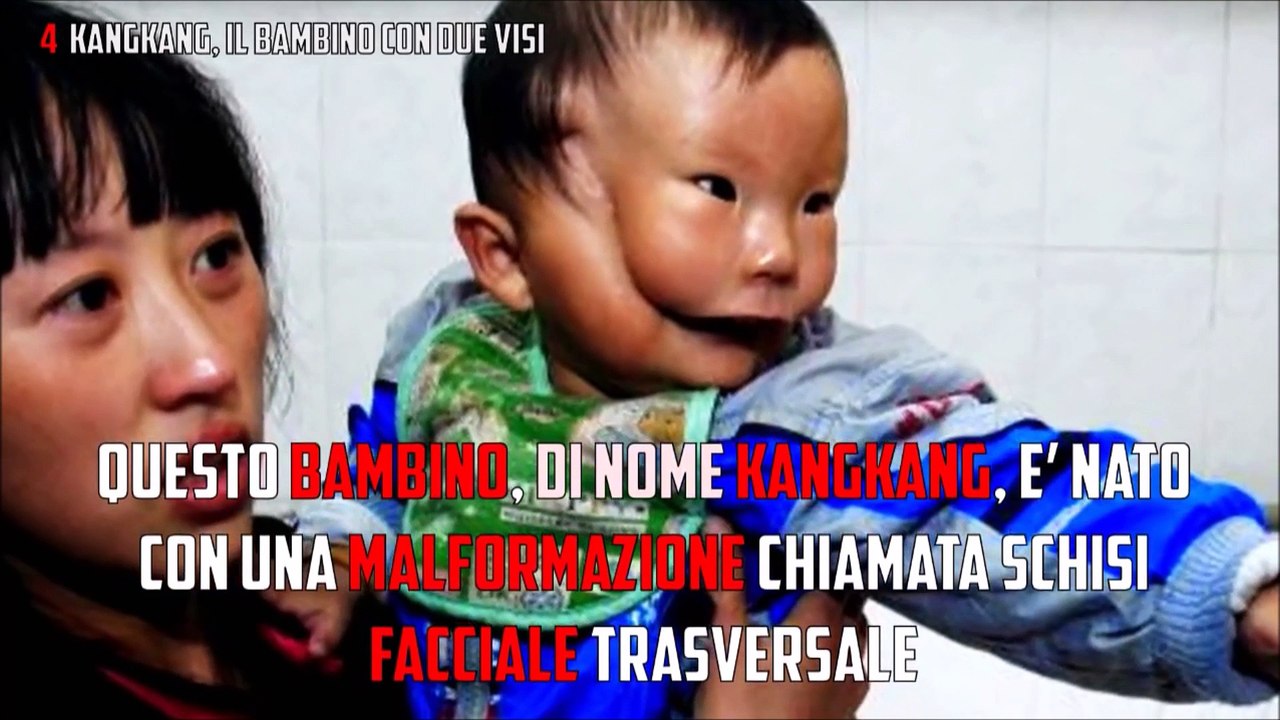 5 persone con parti del corpo extra...