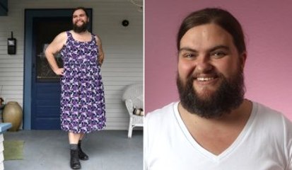 Sakallı Kadın: Kendimi Böyle Daha Çekici Hissediyorum