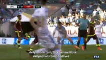 Roberto Rosales break his leg during Uruguay 0-0 Venezuela