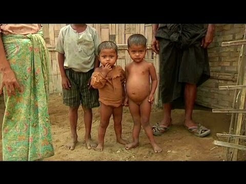 Children in Arakan State face malnutrition after aid workers' exodus