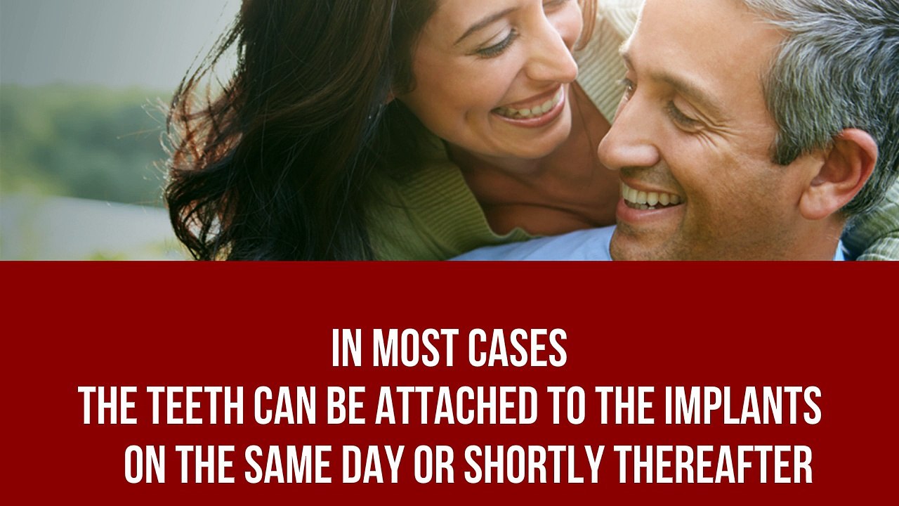 Teeth-On-4 - Latest innovation in dental implants