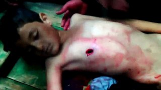Suriyede KaraPropaganda Katledilen Masum Bebekler ve Çocuklar 23