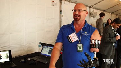 Prosthetic arm, robot arm for disability - My Village