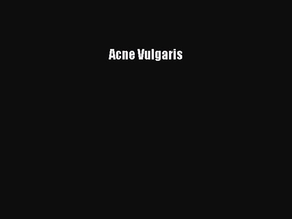 Read Acne Vulgaris Ebook Free