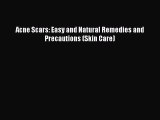 Download Acne Scars: Easy and Natural Remedies and Precautions (Skin Care) Ebook Free