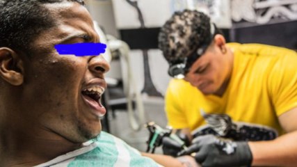 【閲覧注意】刺青を除去する為にレーザー手術受けたら腕がガチでヤバい状態に…■アウトロー伝説