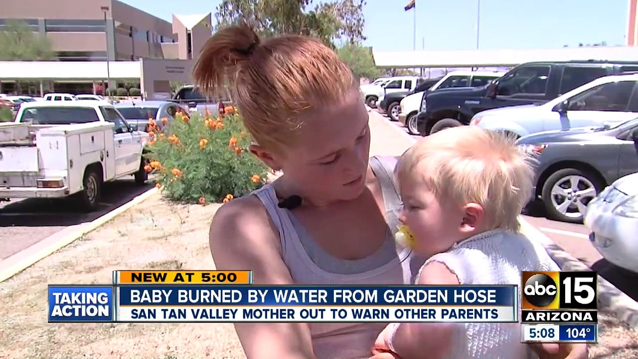 Un bébé de 9 mois brûlé au deuxième degré par l'eau d'un boyau d'arrosage.
