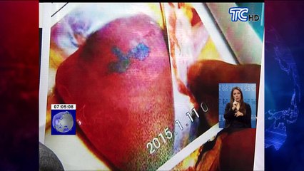 Caso muerte Reina de Durán continuará