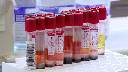 Siguria e gjakut, analizat në kohë rekord - Top Channel Albania - News - Lajme