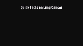 Read Books Quick Facts on Lung Cancer ebook textbooks