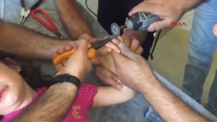 Şanlıurfa 7 Yaşındaki Çocuğun Parmağına Sıkışan Conta Kesilerek Çıkarıldı