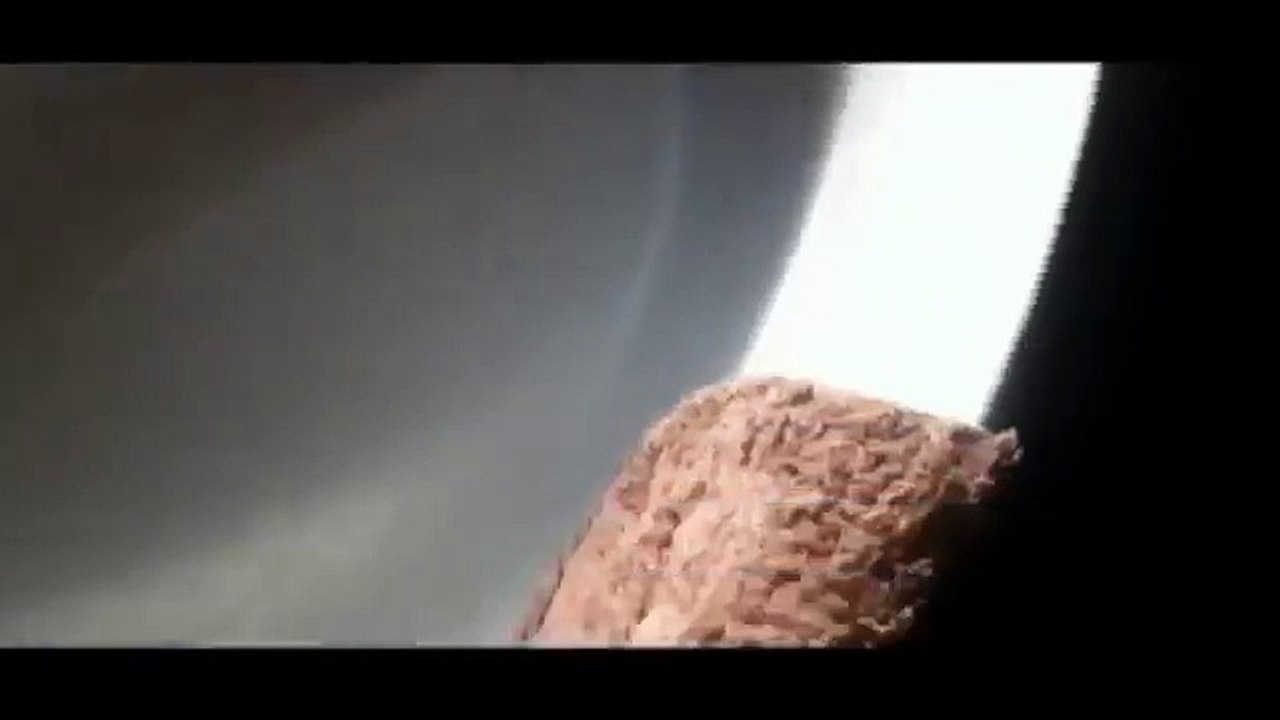 Gli esce un' enorme bolla sul braccio ma non va dal medico. Poi la scioccante scoperta...