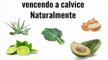 Vencendo a Calvíce - Receitas para curar a Calvíce - YouTube