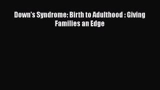 Read Down's Syndrome: Birth to Adulthood : Giving Families an Edge PDF Free