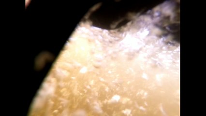 Man Almost Drowns After Crashing a Jet Ski