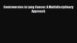 Download Controversies in Lung Cancer: A Multidisciplinary Approach PDF Online