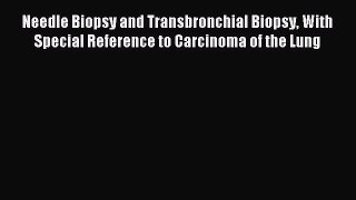 Read Needle Biopsy and Transbronchial Biopsy With Special Reference to Carcinoma of the Lung