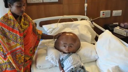 Histoire émouvante de cette petite Indienne miraculée