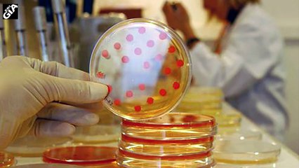 Ils injectent le virus du sida dans des bananes.