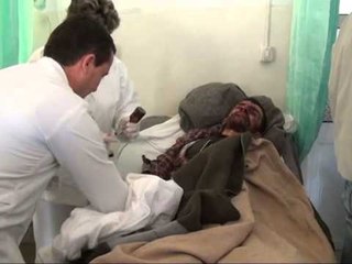 GJENDJA E MINATOREVE NJE PREJ MINATOREVE MBAHET NE KOMA ARTIFICIALE LAJM