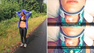 Nikki Bella's post-surgery road to recovery