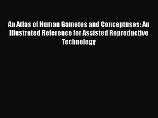 Read An Atlas of Human Gametes and Conceptuses: An Illustrated Reference for Assisted Reproductive