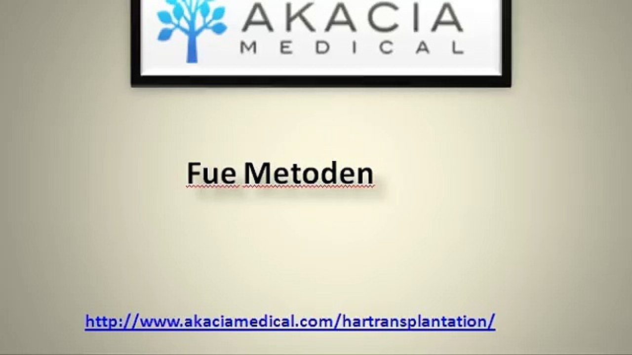 Fue Metoden