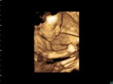 PAMS 4D Baby Scanning, Norwich - 24 Weeks - 4D Baby Scans