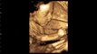 PAMS 4D Baby Scanning, Norwich - 24 Weeks - 4D Baby Scans