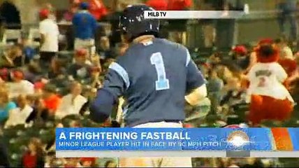 Il prend une balle de Baseball en plein visage !