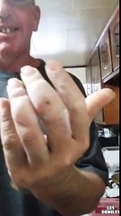 Un homme perce son bouton et boit son pus !