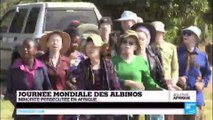 1ère journée mondiale des Albinos - Une minorité persécutée en Afrique