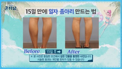 [최고의 1분] 종아리 보톡스의 효과와 부작용