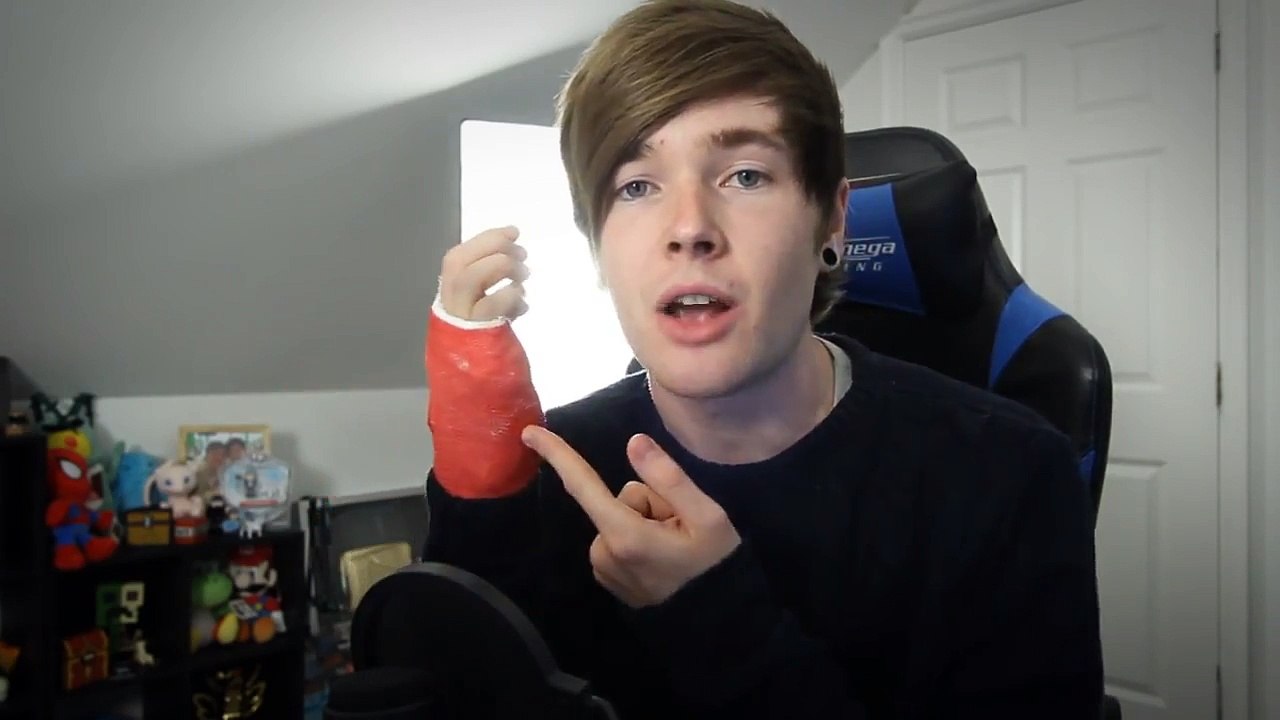 TheDiamondMinecart // DanTDM |      BROKEN HAND UPDATE #2!!