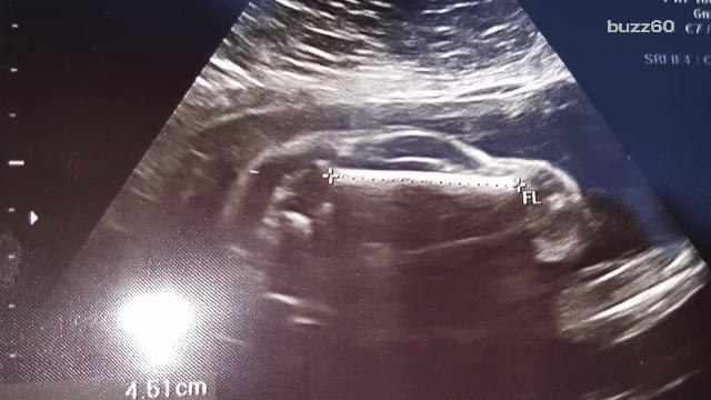 Couple's Sonogram Image Suggests Their Baby Might Actually Be A Car