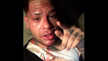 Almighty el artista urbano puertoriqueño fue agredido y culpa a Farruko