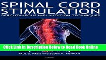 Download Spinal Cord Stimulation Implantation: Percutaneous Implantation Techniques  PDF Online